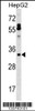 Western blot analysis in HepG2 cell line lysates (35ug/lane) .