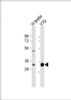 Western Blot at 1:1000 dilution Lane 1: human testis lysate Lane 2: Y79 whole cell lysate Lysates/proteins at 20 ug per lane.