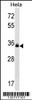 Western blot analysis in Hela cell line lysates (35ug/lane) .