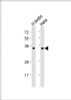 Western Blot at 1:1000 dilution Lane 1: human testis lysate Lane 2: Hela whole cell lysate Lysates/proteins at 20 ug per lane.