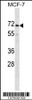 Western blot analysis in MCF-7 cell line lysates (35ug/lane) .