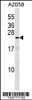 Western blot analysis in A2058 cell line lysates (35ug/lane) .