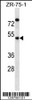 Western blot analysis in ZR-75-1 cell line lysates (35ug/lane) .