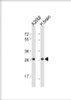 Western Blot at 1:1000 dilution Lane 1: A2058 whole cell lysate Lane 2: human brain lysate Lysates/proteins at 20 ug per lane.