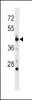 Western blot analysis in mouse spleen tissue lysates (35ug/lane) .