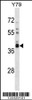 Western blot analysis in Y79 cell line lysates (35ug/lane) .