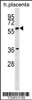 Western blot analysis in human placenta tissue lysates (35ug/lane) .