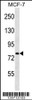 Western blot analysis in MCF-7 cell line lysates (35ug/lane) .