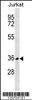 Western blot analysis in Jurkat cell line lysates (35ug/lane) .