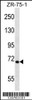 Western blot analysis in ZR-75-1 cell line lysates (35ug/lane) .