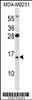 Western blot analysis in MDA-MB231 cell line lysates (35ug/lane) .