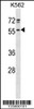 Western blot analysis in K562 cell line lysates (35ug/lane) .