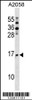 Western blot analysis in A2058 cell line lysates (35ug/lane) .