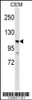 Western blot analysis in CEM cell line lysates (35ug/lane) .