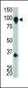 Antibody is used in Western blot to detect GRPRC1H in mouse brain tissue lysate.