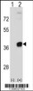Western blot analysis of PRPS2 using rabbit polyclonal PRPS2 Antibody using 293 cell lysates (2 ug/lane) either nontransfected (Lane 1) or transiently transfected (Lane 2) with the PRPS2 gene.