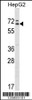 Western blot analysis in HepG2 cell line lysates (35ug/lane) .