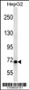 Western blot analysis in HepG2 cell line lysates (35ug/lane) .