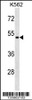 Western blot analysis in K562 cell line lysates (35ug/lane) .