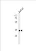 Western blot analysis in Jurkat cell line lysates (35ug/lane) .