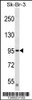 Western blot analysis in SK-BR-3 cell line lysates (35ug/lane) .