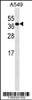 Western blot analysis in A549 cell line lysates (35ug/lane) .