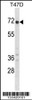 Western blot analysis in T47D cell line lysates (35ug/lane) .