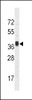 Western blot analysis in mouse liver tissue lysates (35ug/lane) .