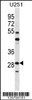 Western blot analysis in U251 cell line lysates (35ug/lane) .