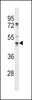 Western blot analysis in A375 cell line lysates (35ug/lane) .