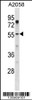 Western blot analysis in A2058 cell line lysates (35ug/lane) .