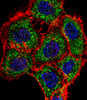 Fluorescent confocal image of A431 cell stained with TSC22D2 Antibody (N-term) .A431 cells were fixed with 4% PFA (20 min) , permeabilized with Triton X-100 (0.1%, 10 min) , then incubated with TSC22D2 primary antibody (1:25) . For secondary antibody, Alexa Fluor 488 conjugated donkey anti-rabbit antibody (green) was used (1:400) .Cytoplasmic actin was counterstained with Alexa Fluor 555 (red) conjugated Phalloidin (7units/ml) . Nuclei were counterstained with DAPI (blue) (10 ug/ml, 10 min) . TSC22D2 immunoreactivity is localized to Cytoplasm significantly.