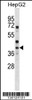 Western blot analysis in HepG2 cell line lysates (35ug/lane) .