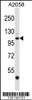 Western blot analysis in A2058 cell line lysates (35ug/lane) .