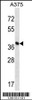 Western blot analysis in A375 cell line lysates (35ug/lane) .