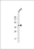 Western Blot at 1:1000 dilution + Jurkat whole cell lysate Lysates/proteins at 20 ug per lane.