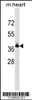 Western blot analysis in mouse heart tissue lysates (35ug/lane) .