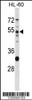 Western blot analysis in HL-60 cell line lysates (35ug/lane) .