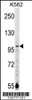 Western blot analysis in K562 cell line lysates (35ug/lane) .