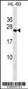 Western blot analysis in HL-60 cell line lysates (35ug/lane) .