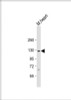 Western Blot at 1:2000 dilution + mouse heart lysate Lysates/proteins at 20 ug per lane.