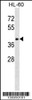 Western blot analysis in HL-60 cell line lysates (35ug/lane) .