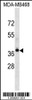 Western blot analysis in MDA-MB468 cell line lysates (35ug/lane) .