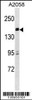 Western blot analysis in A2058 cell line lysates (35ug/lane) .