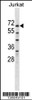 Western blot analysis in Jurkat cell line lysates (35ug/lane) .