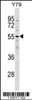 Western blot analysis in Y79 cell line lysates (35ug/lane) .