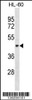 Western blot analysis in HL-60 cell line lysates (35ug/lane) .