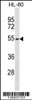 Western blot analysis in HL-60 cell line lysates (35ug/lane) .