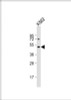 Western Blot at 1:2000 dilution + K562 whole cell lysate Lysates/proteins at 20 ug per lane.