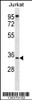 Western blot analysis in Jurkat cell line lysates (35ug/lane) .